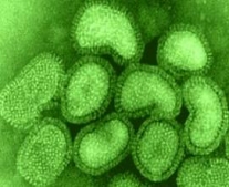 منظمة الصحة العالمية تعلن مرض إنفلونزا الخنازير"H1N1" وباء عالمي